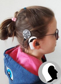 CI Kopf 2018 weiblich Kind